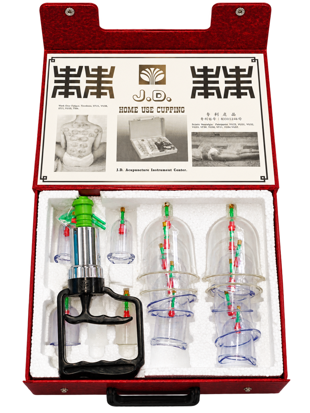 Schröpfglas-Set im roten Koffer mit Handpumpe und mehreren transparenten Gläsern, Deckel mit J.D. Home Use Cupping