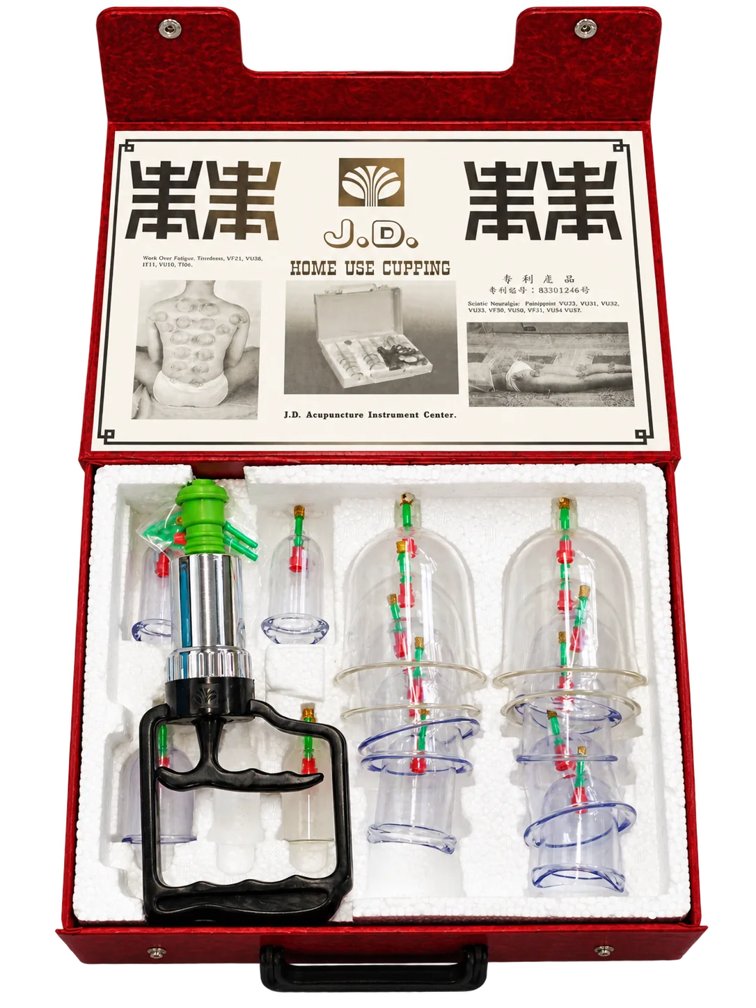 Schröpfglas-Set im roten Koffer mit Handpumpe und mehreren transparenten Gläsern, Deckel mit J.D. Home Use Cupping